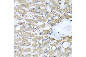 Immunohistochemistry (Paraffin-embedded Sections) (IHC (p)) image for anti-NADH Dehydrogenase (Ubiquinone) Fe-S Protein 3, 30kDa (NADH-Coenzyme Q Reductase) (NDUFS3) (AA 37-264) antibody (ABIN6144486)