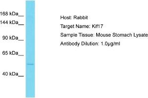 Host: Rabbit Target Name: Kif17 Sample Type: Mouse Stomach lysates Antibody Dilution: 1.