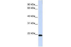 TJAP1 antibody used at 1 ug/ml to detect target protein. (TJAP1 Antikörper)