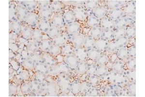 ABIN6256410 and ABIN6267508 at 1/200 staining Rat kidney tissue sections by IHC-P.