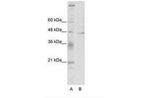 Image no. 1 for anti-Tumor Susceptibility Gene 101 (TSG101) (C-Term) antibody (ABIN202407) (TSG101 Antikörper  (C-Term))