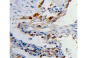 Used in DAB staining on fromalin fixed paraffin-embedded lung tissue (Latexin Antikörper  (AA 1-222))