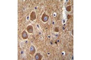 Immunohistochemistry analysis in formalin fixed and paraffin embedded human brain tissue reacted with AP53154PU-N, which was peroxidase conjugated to the secondary antibody and followed by DAB staining. (PAK6 Antikörper  (Middle Region))