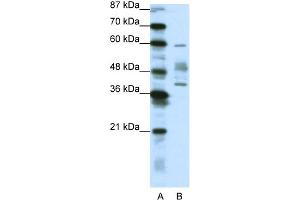 WB Suggested Anti-APTX Antibody Titration:  1. (Aprataxin Antikörper  (N-Term))