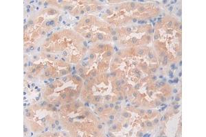 Used in DAB staining on fromalin fixed paraffin- embedded Kidney tissue (ANGPTL5 Antikörper  (AA 141-383))