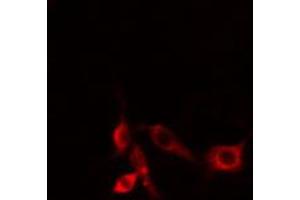 ABIN6274486 staining HepG2 cells by IF/ICC. (MAP3K3 Antikörper  (N-Term))