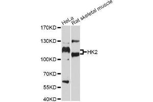 Western Blotting (WB) image for anti-Hexokinase 2 (HK2) (AA 1-120) antibody (ABIN3021256)