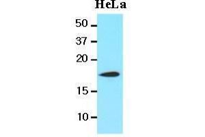 The lysates of HeLa(20 ug) were resolved by SDS-PAGE, transferred to nitrocellulose membrane and probed with anti-human Cofilin 1(1:1000) antibody. (Cofilin Antikörper  (AA 1-166))