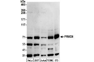 anti-FERM Domain Containing 6 (FRMD6) (AA 572-622) antibody