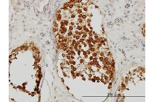 Immunoperoxidase of monoclonal antibody to DAZ1 on formalin-fixed paraffin-embedded human testis. (DAZ1 Antikörper  (AA 21-120))
