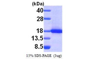 SDS-PAGE (SDS) image for SH2 Domain Containing 1A (SH2D1A) (AA 1-128) protein (His tag) (ABIN667264) (SH2D1A Protein (AA 1-128) (His tag))