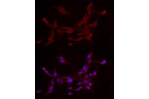Immunofluorescence (IF) image for anti-ADAM Metallopeptidase with Thrombospondin Type 1 Motif, 1 (ADAMTS1) (AA 718-967) antibody (ABIN7265439)