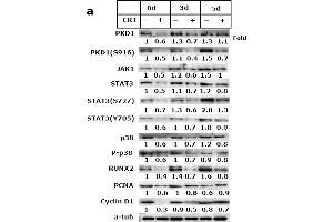 Western Blotting (WB) image for anti-Runt-Related Transcription Factor 2 (RUNX2) (AA 242-521) antibody (ABIN3016834)