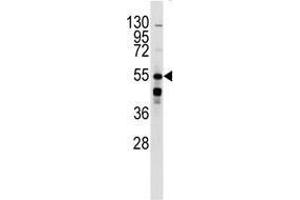 Western blot analysis of anti-BAR2 Antibody in mouse kidney lysates (35 µg/lane). (beta 2 Adrenergic Receptor Antikörper  (Ser261))
