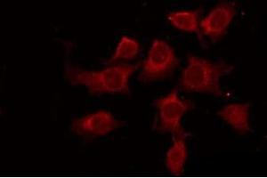 Immunofluorescence (fixed cells) (IF/ICC) image for anti-BCL2-Like 1 (BCL2L1) (N-Term) antibody (ABIN6260226)