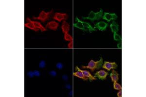 ABIN6256941 and ABIN6274588 staining Hela cells by IF/ICC. (beta Arrestin 1 Antikörper  (C-Term))