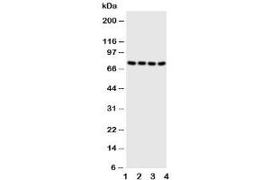 Western blot testing of PAK6 antibody and Lane 1:  HeLa (PAK6 Antikörper  (N-Term))