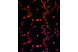 Immunofluorescence analysis of NIH/3T3 cells using P Glycoprotein antibody (ABIN6129943, ABIN6136341, ABIN6136344 and ABIN6216612) at dilution of 1:100. (ABCB1 Antikörper  (AA 630-710))