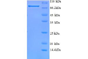 SDS-PAGE (SDS) image for T-Complex 1 (TCP1) (AA 1-680), (full length) protein (His tag) (ABIN5712790)