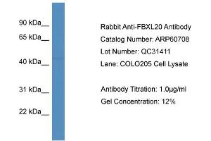 Western Blotting (WB) image for anti-F-Box and Leucine-Rich Repeat Protein 20 (FBXL20) (Middle Region) antibody (ABIN2788547) (FBXL20 Antikörper  (Middle Region))