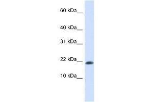 GABARAPL2 antibody used at 1 ug/ml to detect target protein. (GABARAPL2 Antikörper)