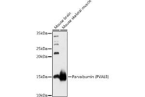 Western blot analysis of extracts of various cell lines, using Parvalbumin (PVALB) antibody (ABIN6128526, ABIN6146506, ABIN6146507 and ABIN6217573) at 1:1000 dilution. (PVALB Antikörper  (AA 1-110))