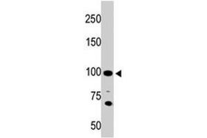 The ACE2 polyclonal antibody  is used in Western blot to detect ACE2 in 293 cell lysate. (ACE2 Antikörper  (AA 773-805))