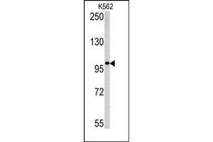 Image no. 1 for anti-Melanoma Antigen Family C, 1 (MAGEC1) (C-Term) antibody (ABIN358656) (MAGEC1 Antikörper  (C-Term))