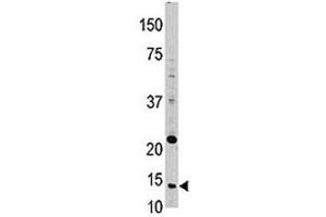 Western Blotting (WB) image for anti-Thioredoxin (TXN) (AA 1-30) antibody (ABIN3029119)