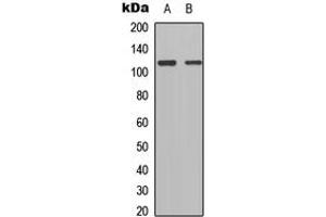 Western blot analysis of TSHZ1 expression in HEK293T (A), Raw264. (TSHZ1 Antikörper  (C-Term))