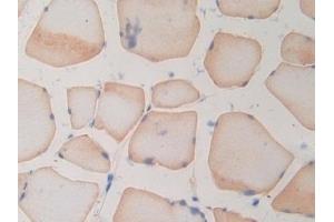 Detection of RNASE3 in Rat Skeletal muscle Tissue using Polyclonal Antibody to Ribonuclease A3 (RNASE3) (RNASE3 Antikörper  (AA 33-155))