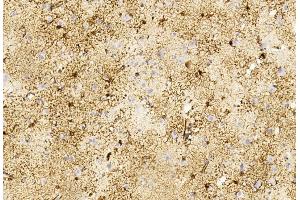 Immunohistochemical analysis of paraffin-embedded Human brain section using Pink1 B. (GFAP Antikörper)