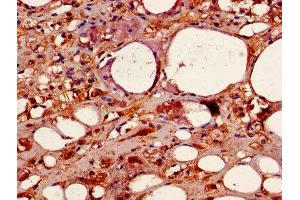 Immunohistochemistry of paraffin-embedded human adrenal gland tissue using ABIN7146893 at dilution of 1:100 (CSNK2B Antikörper  (AA 1-215))