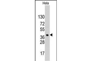Western blot analysis of anti-HDGF Pab (ABIN390356 and ABIN2840767) in Hela cell line lysates (35 μg/lane). (HDGF Antikörper  (C-Term))