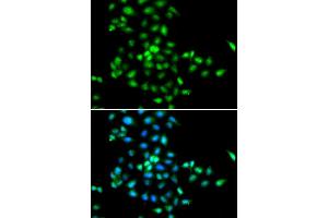 Immunofluorescence (IF) image for anti-Shwachman-Bodian-Diamond Syndrome (SBDS) antibody (ABIN1980243) (SBDS Antikörper)