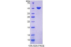 SDS-PAGE (SDS) image for Caveolin 1, Caveolae Protein, 22kDa (CAV1) (AA 2-104) protein (His tag,GST tag) (ABIN1878087)