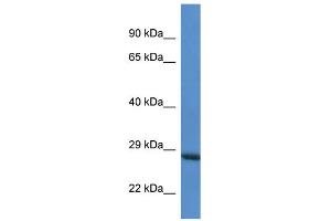 WB Suggested Anti-RAB6C AntibodyTitration: 1. (WTH3DI Antikörper  (Middle Region))
