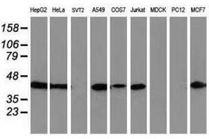 Image no. 3 for anti-ADP-Ribosylation Factor GTPase Activating Protein 1 (ARFGAP1) antibody (ABIN1496683) (ARFGAP1 Antikörper)