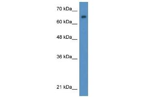 WB Suggested Anti-WT1 Antibody Titration:  0. (WT1 Antikörper  (N-Term))