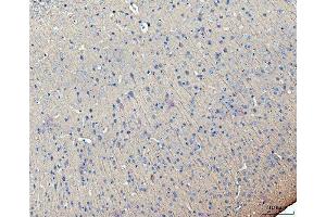 IHC analysis of MAP2 using anti-MAP2 antibody (ABIN7601483). (MAP2 Antikörper  (AA 360-1101))