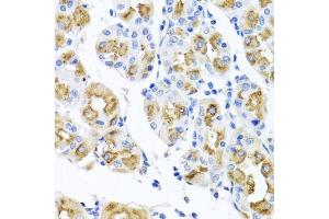 Immunohistochemistry of paraffin-embedded human stomach using FECH antibody (ABIN6130423, ABIN6140573, ABIN6140574 and ABIN6224474) at dilution of 1:100 (40x lens). (FECH Antikörper  (AA 1-200))