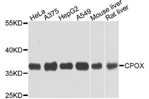 Western blot analysis of extracts of various cells, using CPOX antibody. (CPOX Antikörper)
