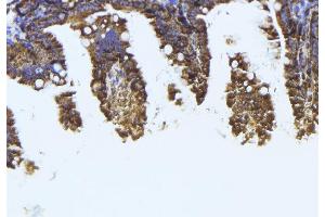 ABIN6273994 at 1/100 staining Mouse colon tissue by IHC-P. (TUBB1 Antikörper)