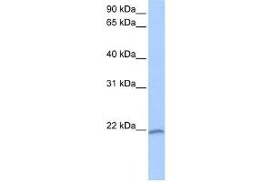 Western Blot showing C8orf77 antibody used at a concentration of 1-2 ug/ml to detect its target protein. (C8orf77 Antikörper  (C-Term))