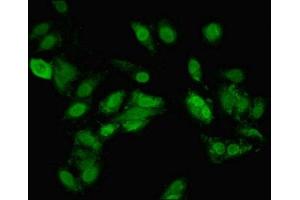 Immunofluorescent analysis of Hela cells using ABIN7171500 at dilution of 1:100 and Alexa Fluor 488-congugated AffiniPure Goat Anti-Rabbit IgG(H+L)