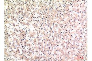 Immunohistochemistry (IHC) analysis of paraffin-embedded Human Liver, antibody was diluted at 1:100. (Complement C4A/C4B (Internal Region) Antikörper)