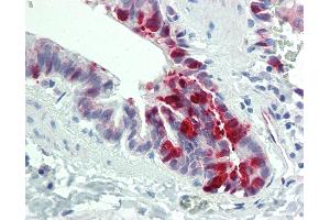 Anti-ALK1 / SLPI antibody IHC staining of human lung, respiratory epithelium. (SLPI Antikörper  (AA 11-60))