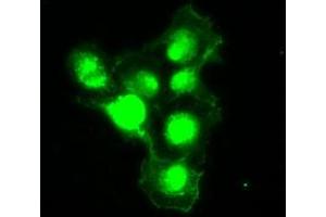 Anti-SILV mouse monoclonal antibody (ABIN2452257) immunofluorescent staining of COS7 cells transiently transfected by pCMV6-ENTRY SILV (RC200663). (Melanoma gp100 Antikörper)