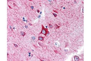 Anti-GABRA1 antibody IHC of human brain, cortex. (GABRA1 Antikörper  (N-Term))