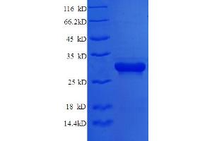 Syntaxin 6 (STX6) (AA 4-231), (partial) protein (His tag)